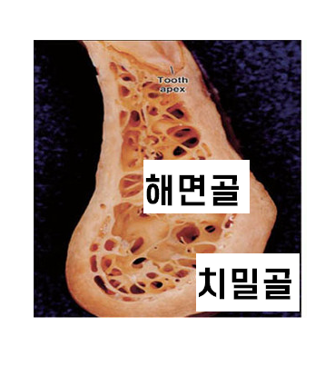 강동구 뼈이식 임플란트 과잉이라 생각하실 수 있지만 진실은 관련 이미지 5