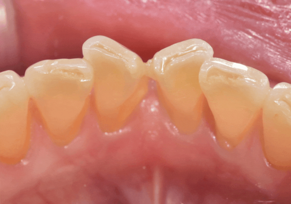 삐딱하게 뻗은 관련 이미지 1