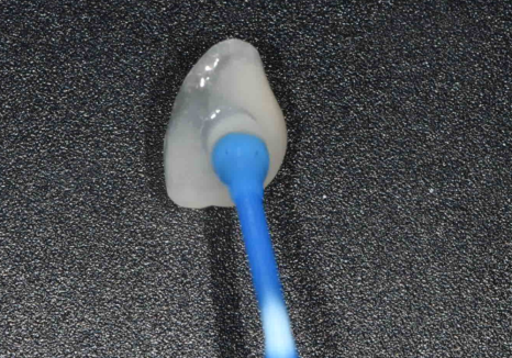 고덕동 무삭제 라미네이트, 실패 없이 하려면 꼭 확인할 3가지 관련 이미지 8