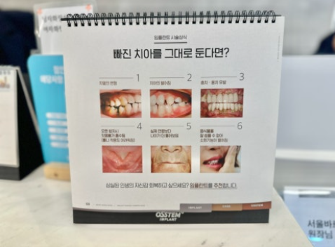 명일동 치과 수면 임플란트 하나요?? 관련 이미지 4