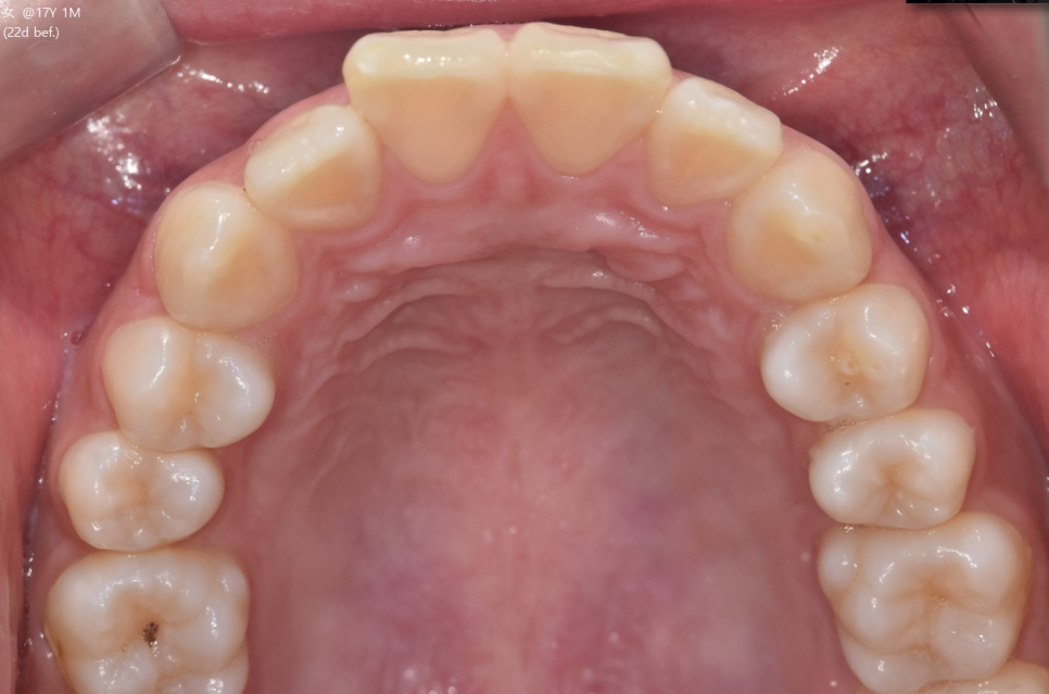 강동구 교정치과 교정 진단비와 관련된 공지 관련 이미지 6