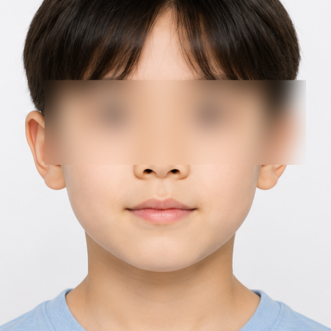우리 아이 주걱턱, "크면서 괜찮아지겠지"가 위험한 이유 관련 이미지 2
