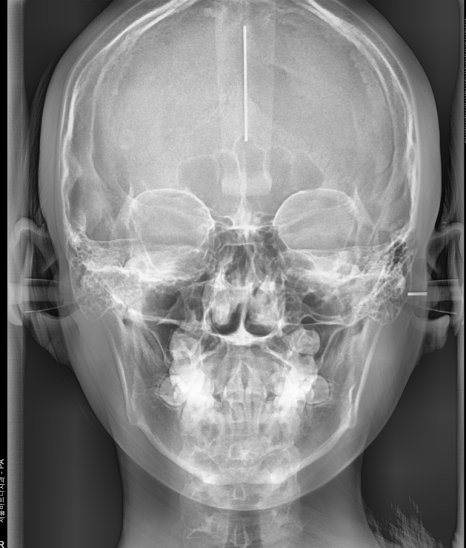 강동구 교정치과 교정 진단비와 관련된 공지 관련 이미지 3