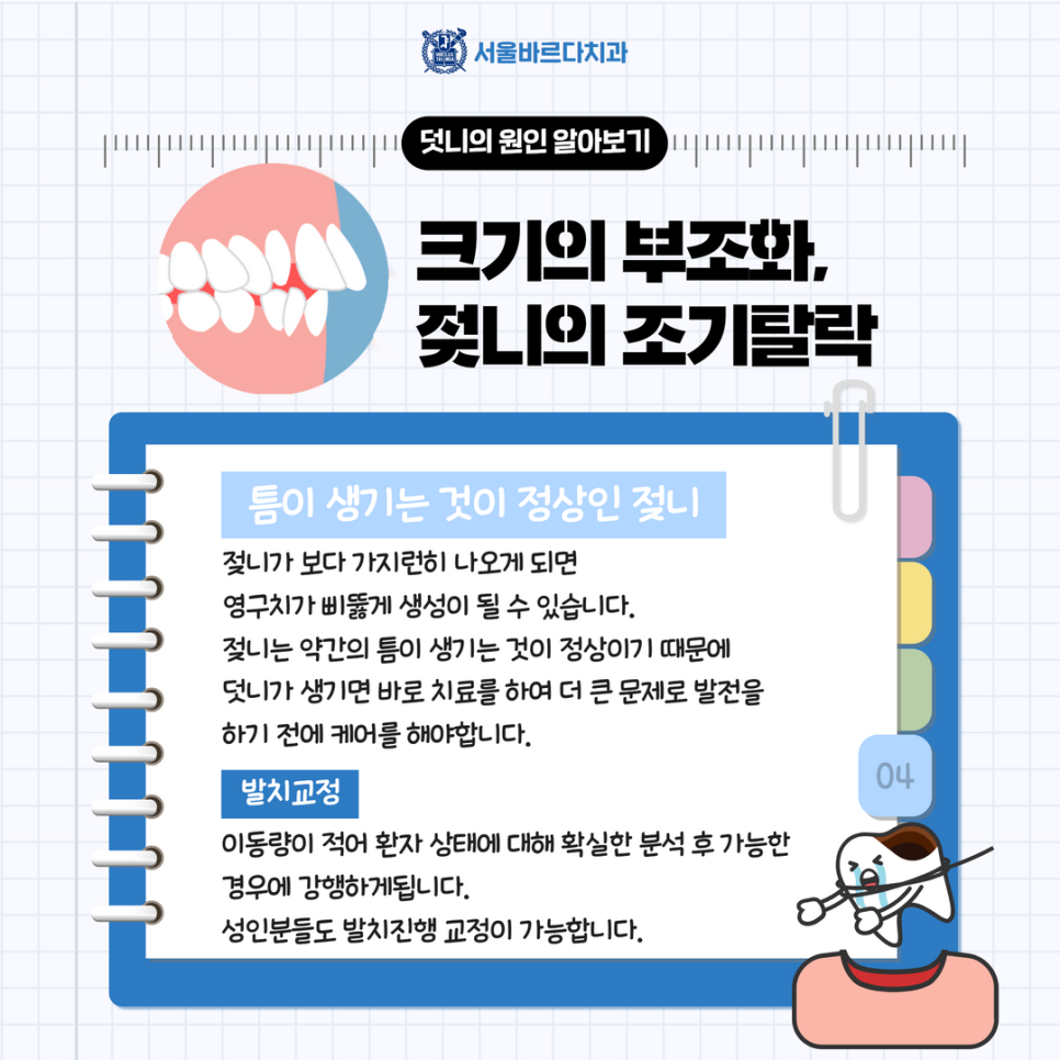 고덕치과 서울바르다치과, 치아교정 발치 꼭 해야만 되는 건가요? 관련 이미지 7