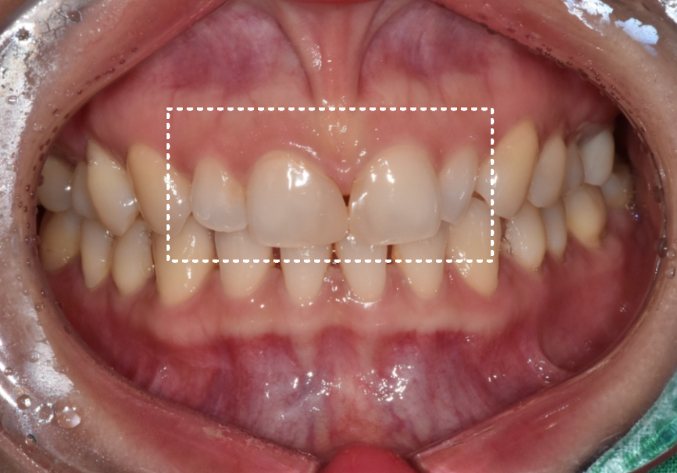 강일동 라미네이트 가격 망설여질 때 꼭 확인해야 할 관련 이미지 3