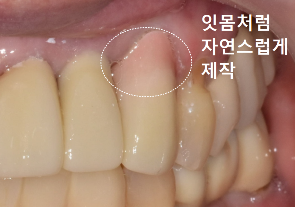 음식물 끼임, 거뭇한 무언가 보인다면? 이미 늦었을 수 있습니다. 관련 이미지 15