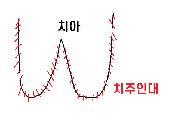 하남 미사 치과 치아 방치하다 올라옴 케이스 보여드립니다. 관련 이미지 7