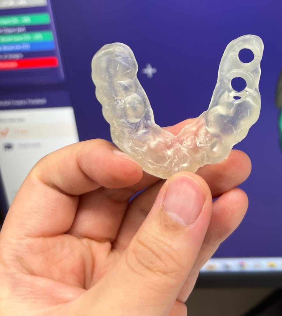 고덕동 치과 디지털 임플란트는 뭔가요? 뭐가 달라요? 관련 이미지 5