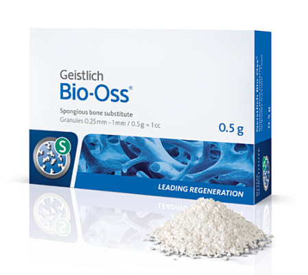 강일동 임플란트 뼈이식재 종류는 뭔가요? 안전성이 걱정되신다면 필독 관련 이미지 6