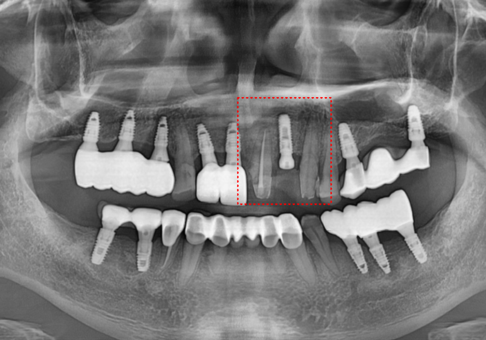 음식물 끼임, 거뭇한 무언가 보인다면? 이미 늦었을 수 있습니다. 관련 이미지 13