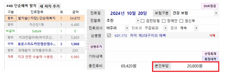 상일동 치과 매복 사랑니 발치 비용 정리해보았습니다!! 관련 이미지 7