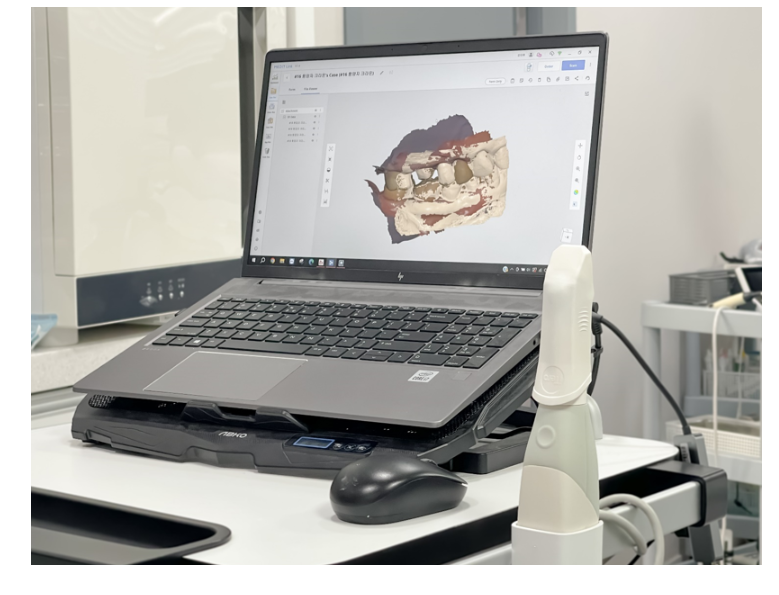 상일동 임플란트 수술 과정 시작부터 끝까지 따라와주세요! 관련 이미지 6