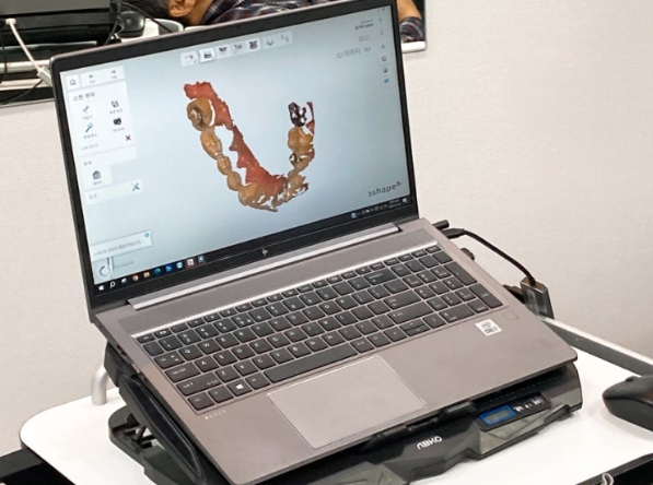 서울바르디치과 임플란트 통증 얼마정도일까? 관련 이미지 3