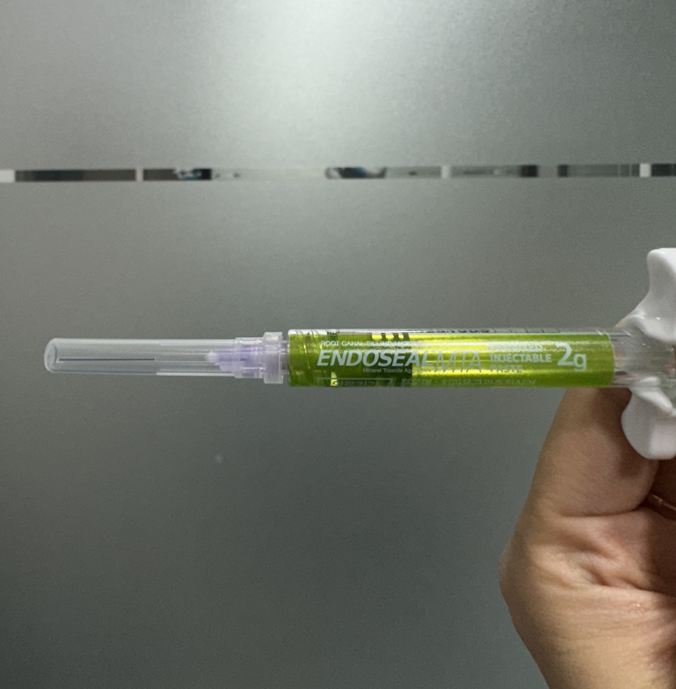 망월동 치과 재신경치료 자연치아 살리기 끝판왕 치료 mta로 가능했습니다. 관련 이미지 7