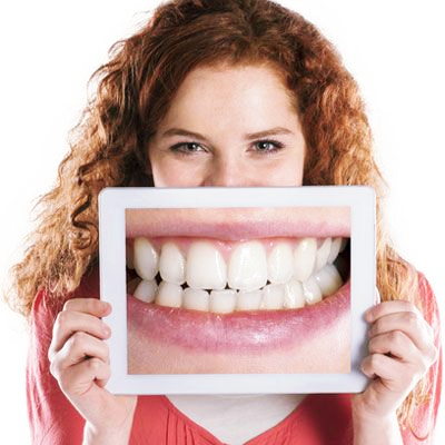 레진치료의 내구성: 얼마나 오래 유지될까? 관련 이미지 2