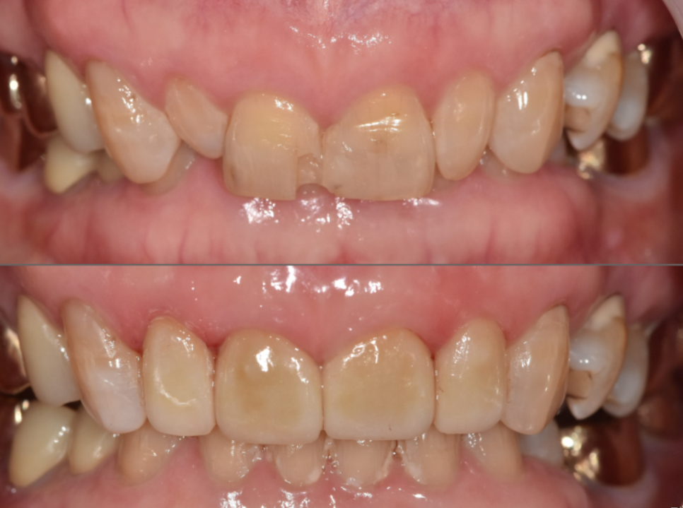 삐딱하게 뻗은 관련 이미지 4