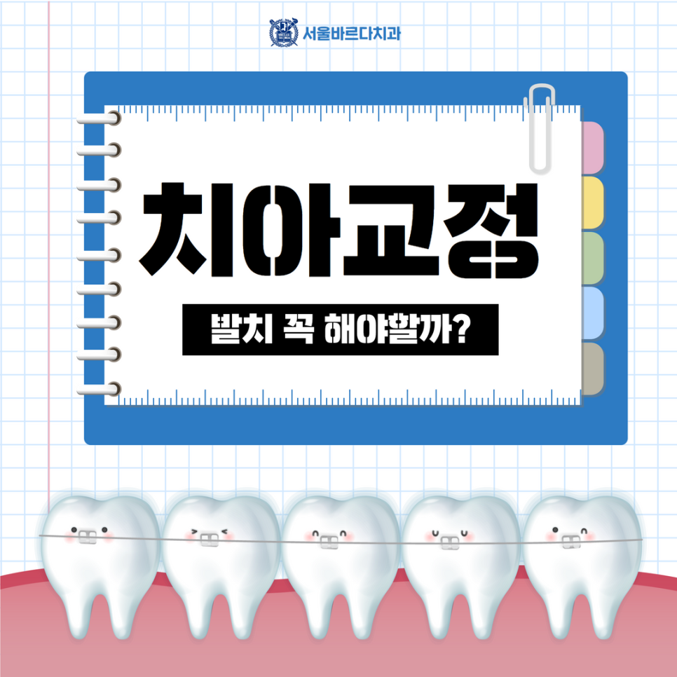 고덕치과 서울바르다치과, 치아교정 발치 꼭 해야만 되는 건가요? 관련 이미지 3
