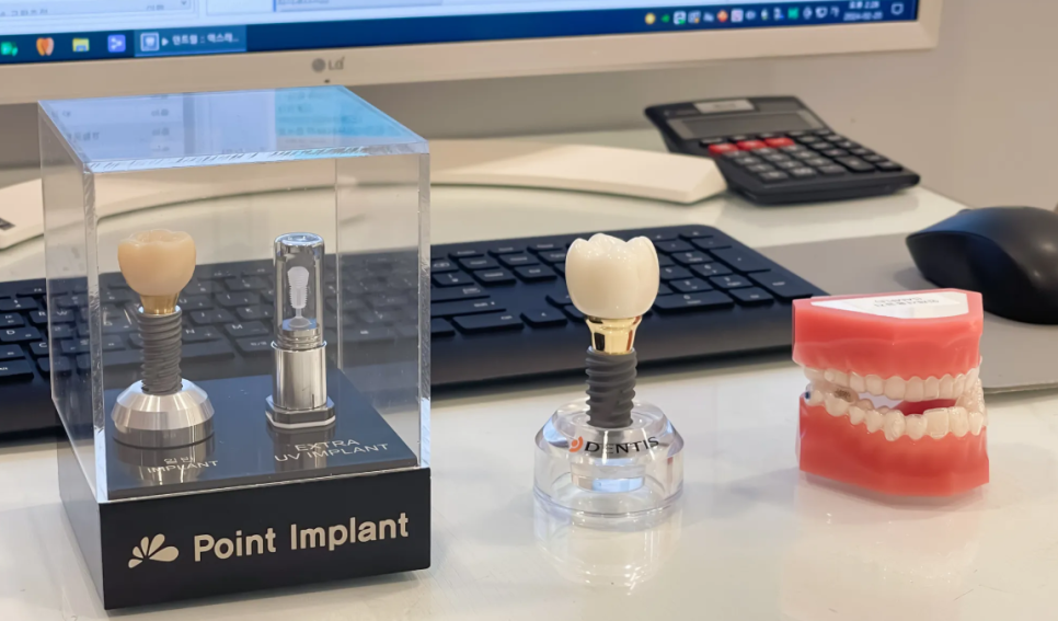 고덕동 임플란트 점검을 꼭! 받으러 와야하는 3가지 이유 관련 이미지 2
