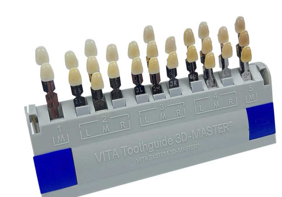 앞니 라미네이트 교체, 재시술 전 꼭 알아야 할 실패를 줄이는 방법 관련 이미지 3