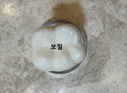 임플란트 수명 유지 관리 방법 도대체 어떻게 해야하나요? 관련 이미지 1