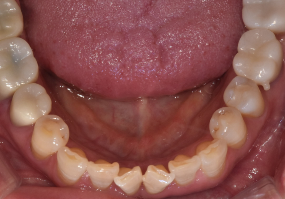 삐딱하게 뻗은 관련 이미지 7