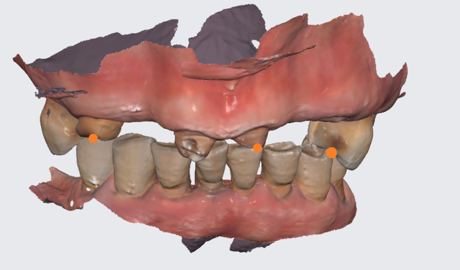추석 효도선물로 임플란트 하세요 치아 없으면 최소 10년은 손해봅니다. 관련 이미지 5