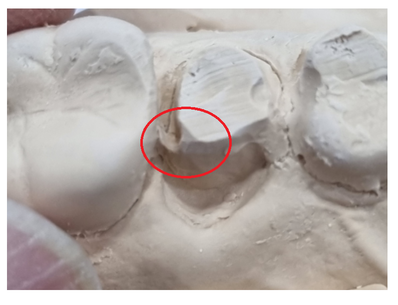 상일동역 임플란트 구강스캐너로 디지털 진료 선두하는 대표 치과입니다! 관련 이미지 3