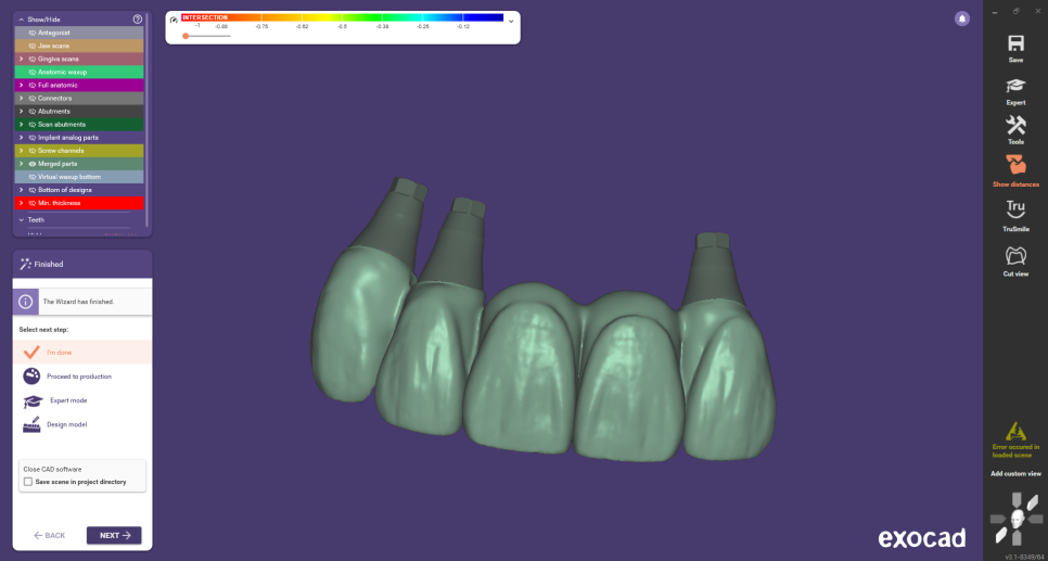 네비게이션 임플란트가 왜 좋다고 그러는거죠? (feat.13가지 장점) 관련 이미지 20