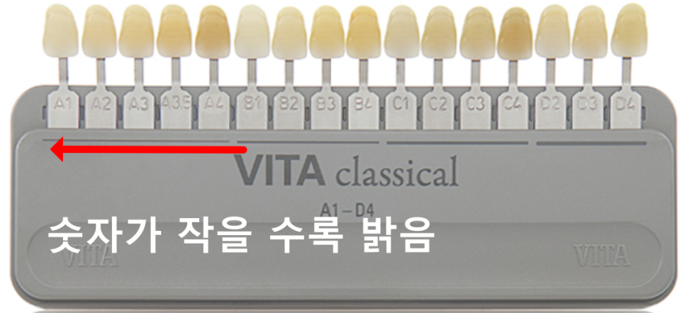 누런 치아 연예인치아 처럼 하얗게 만들 수 있나요? 관련 이미지 9