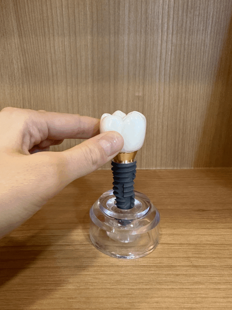 천호동 치과 임플란트 크라운 종류 설명 나갑니다. 관련 이미지 1