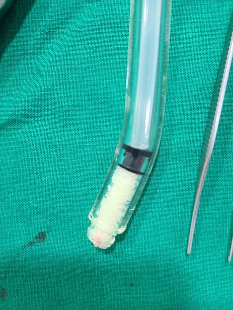 서울 임플란트 병원 선택 전 체크해야할 사항 고민은 이제 그만~ 관련 이미지 8