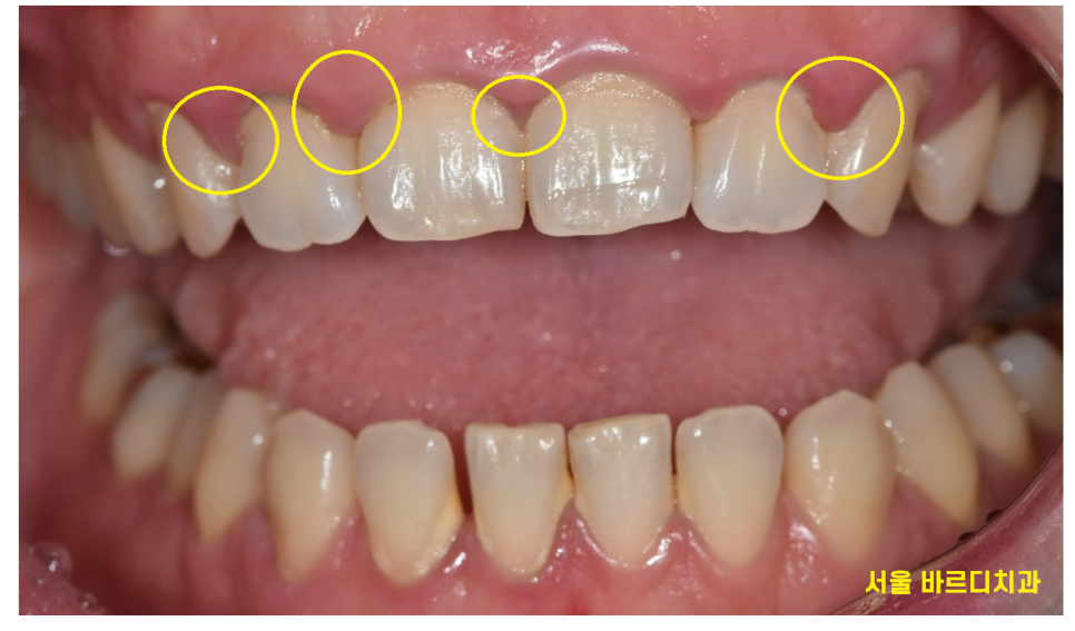 임산부 치과치료 길동 사거리 치과가 알려드립니다. 관련 이미지 1