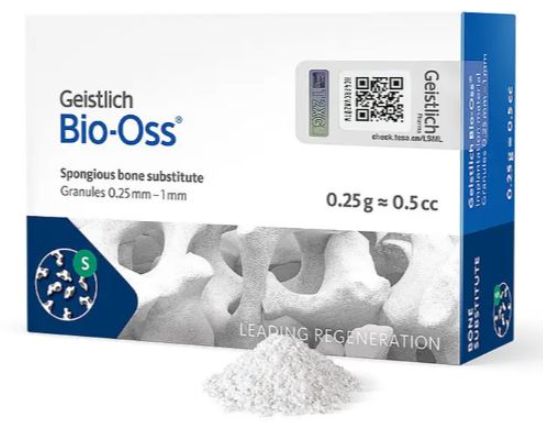 강동구 뼈이식 임플란트 과잉이라 생각하실 수 있지만 진실은 관련 이미지 6