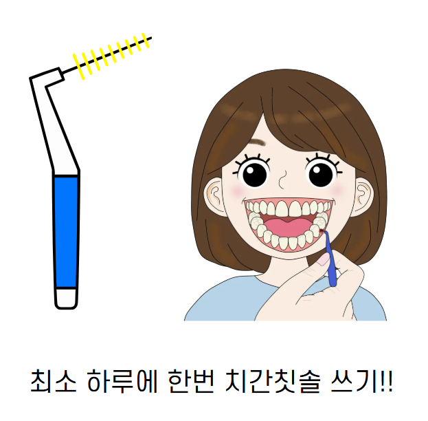 임플란트 잇몸 염증 주위염 증상이 늦게 나타납니다. 관련 이미지 2