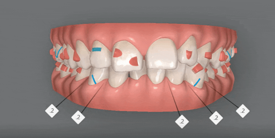 Godeok Station Dental Clinic: If You’re Considering Starting Adult Clear Aligners, Click image 1