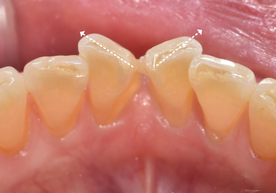 삐딱하게 뻗은 관련 이미지 6