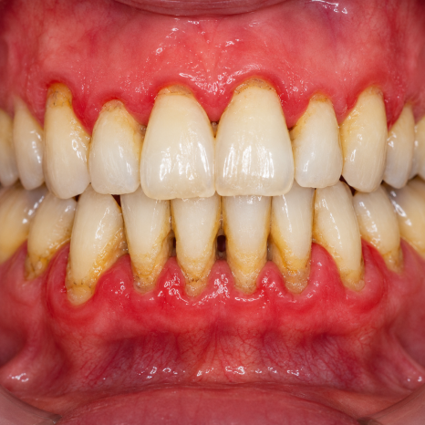 My Tooth Was Loose, Then It Fell Out at Home... image 6