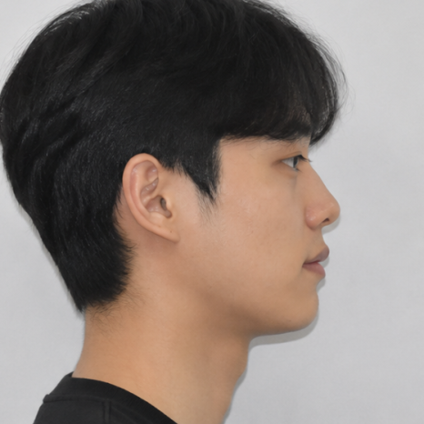 강동구 교정치과 교정 진단 과정이 필요한 이유 관련 이미지 6