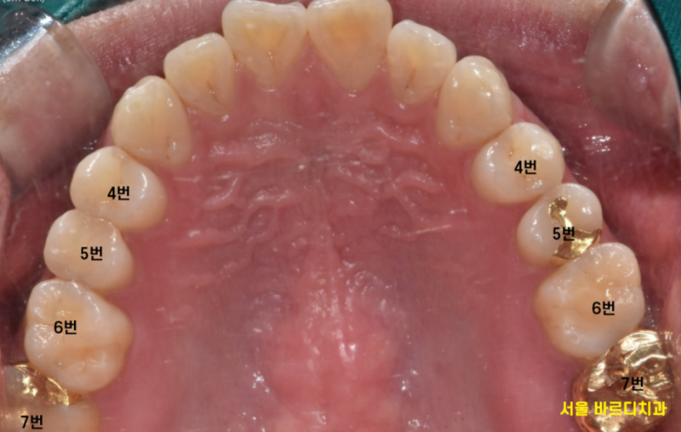 강동 치과 과잉 진료를 피하려면 이것을 확인하세요!! 관련 이미지 4