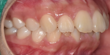 강동구 교정치과 교정 진단비와 관련된 공지 관련 이미지 7