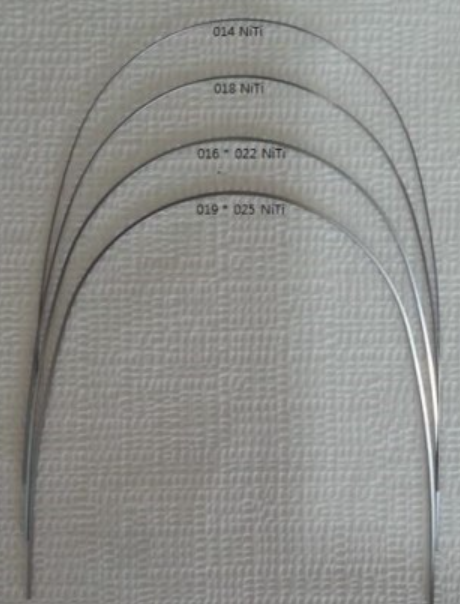 교정 철사 교체 와이어 왜 자꾸 갈까? 주기는? 관련 이미지 5