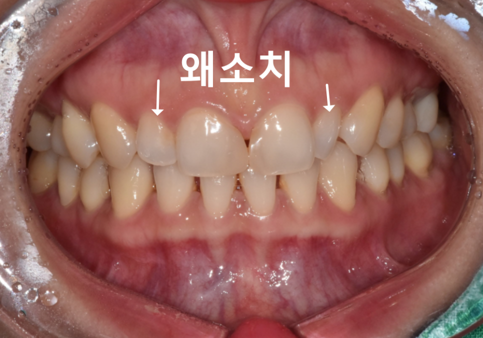 강일동 라미네이트 가격 망설여질 때 꼭 확인해야 할 관련 이미지 2
