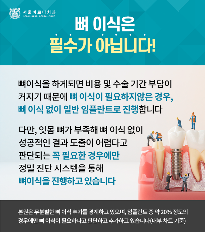 강동구 전체 임플란트 가격, 관련 이미지 1