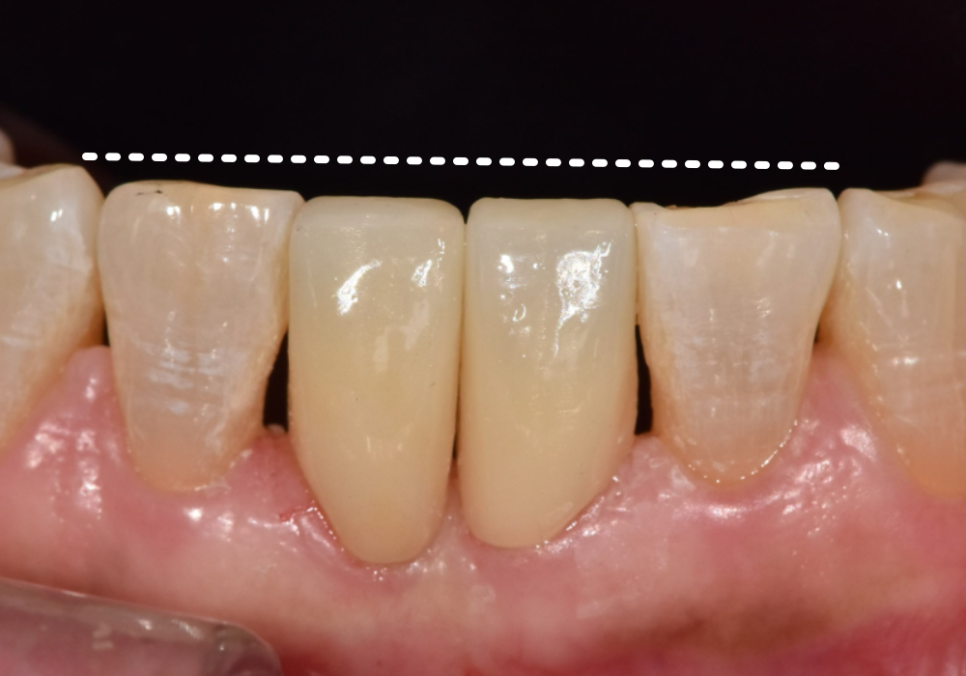 삐딱하게 뻗은 관련 이미지 9