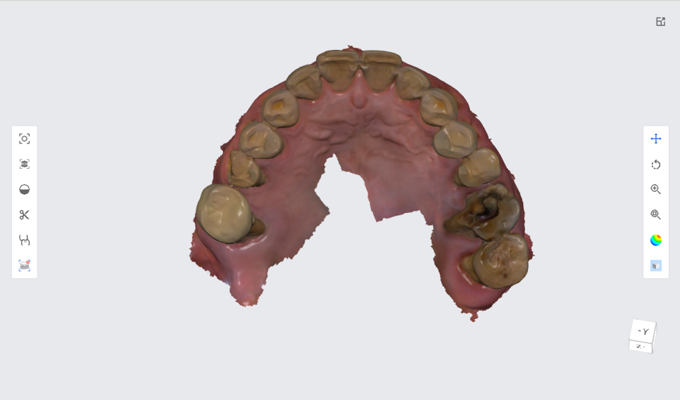 네비게이션 임플란트가 왜 좋다고 그러는거죠? (feat.13가지 장점) 관련 이미지 7