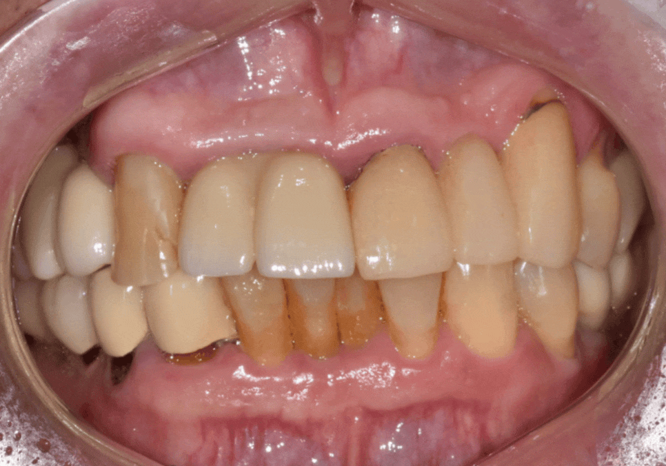 음식물 끼임, 거뭇한 무언가 보인다면? 이미 늦었을 수 있습니다. 관련 이미지 17
