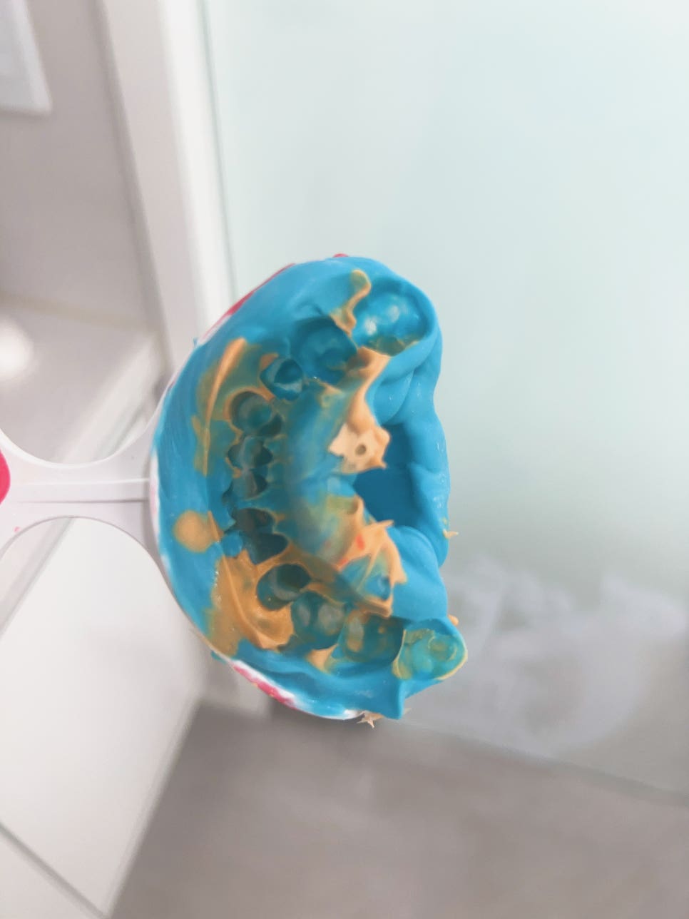 서울바르디치과에서 새로운 3D 구강스캐너, 트리오스를 추가로 도입합니다~ 관련 이미지 6