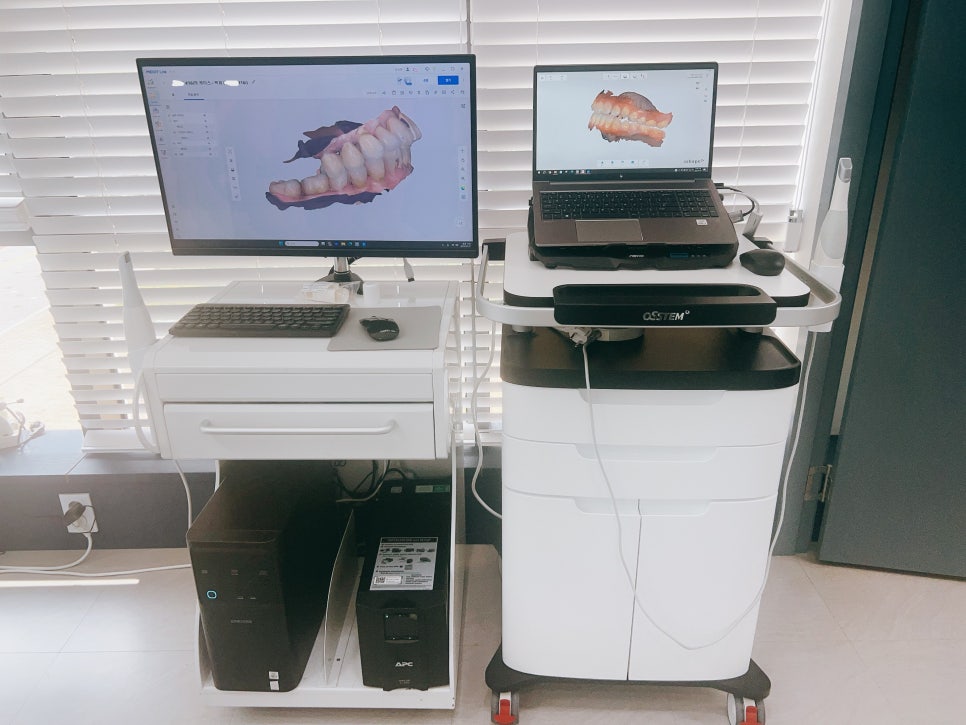 서울바르디치과에서 새로운 3D 구강스캐너, 트리오스를 추가로 도입합니다~ 관련 이미지 5