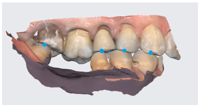 상일동역 임플란트 구강스캐너로 디지털 진료 선두하는 대표 치과입니다! 관련 이미지 7