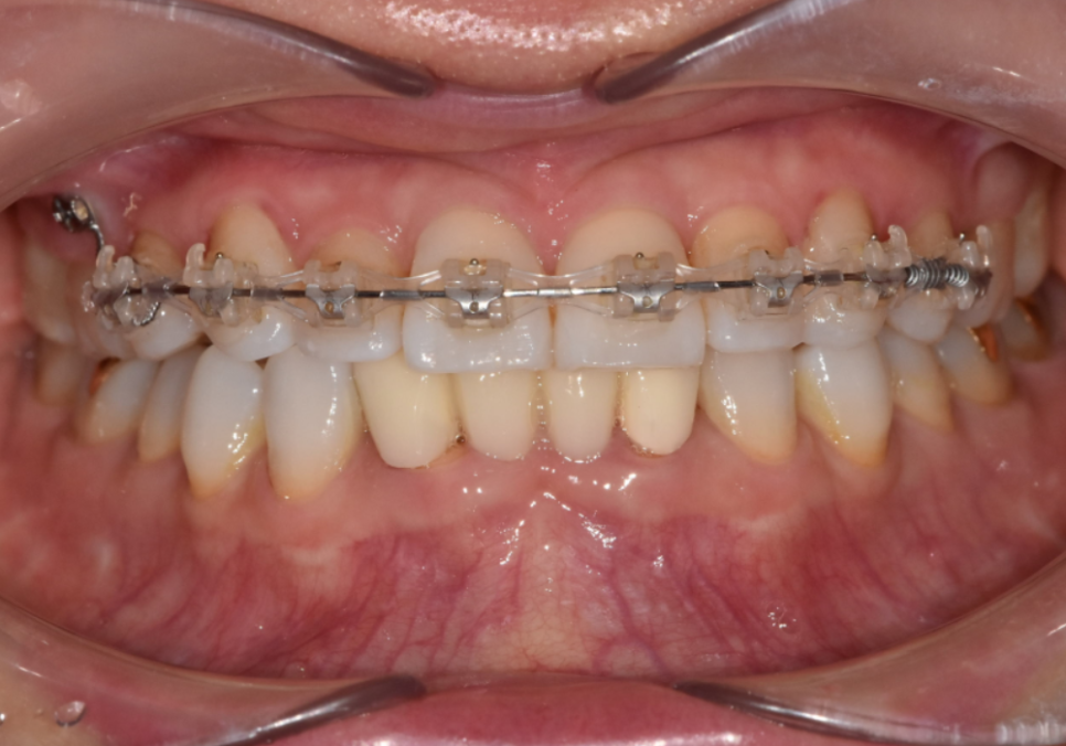 삐딱하게 뻗은 관련 이미지 2